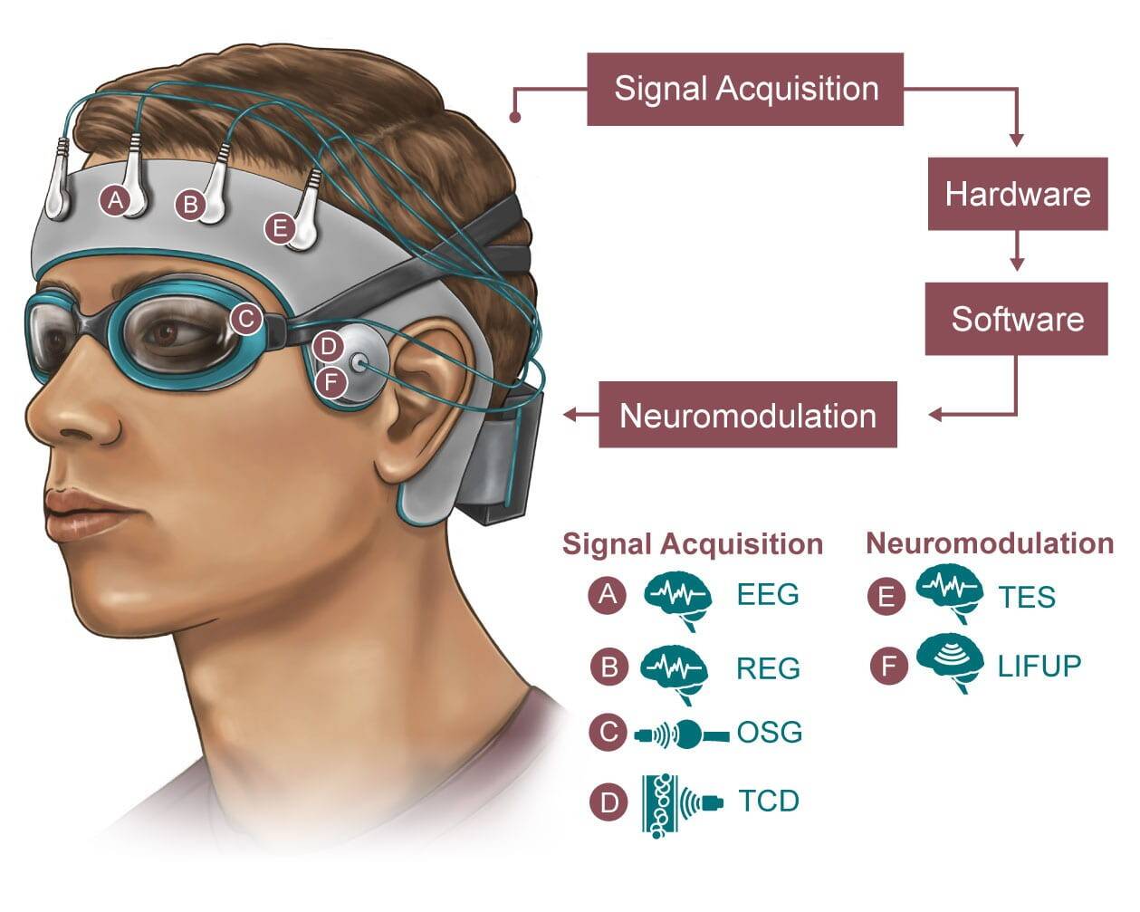 1004_BRAIN-1-web.jpg