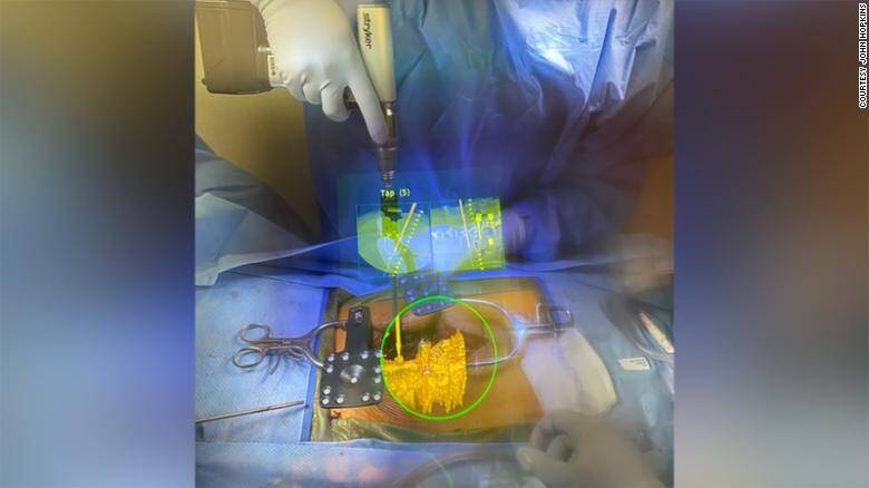 210607144812-01-augmented-surgery-syncar-technology-spc-intl-exlarge-169.jpg