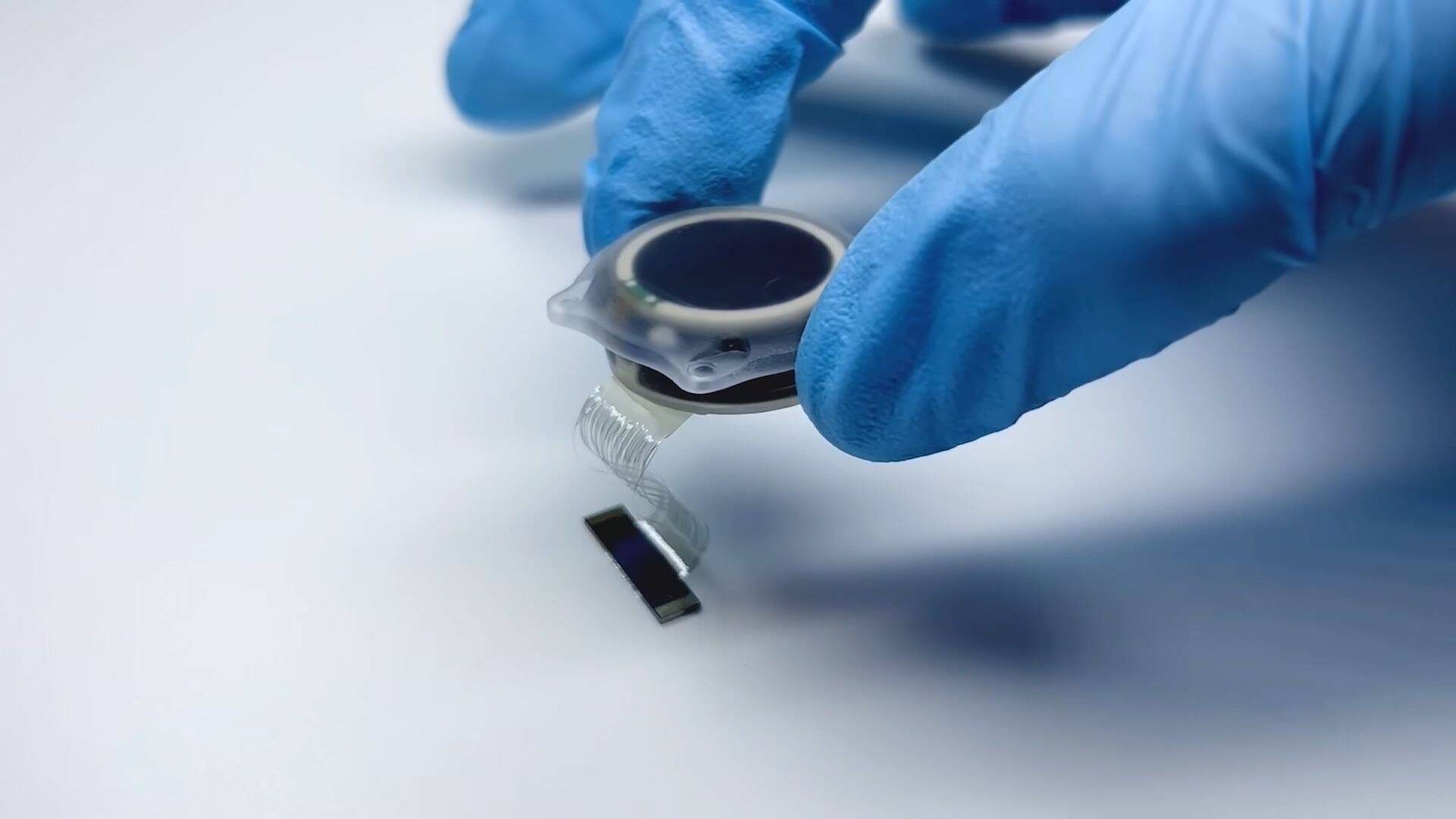 240130172518-neuralink-brain-chip.jpg