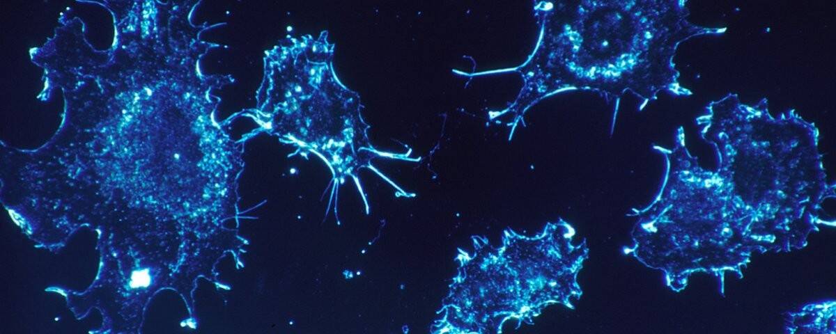 cancer-cells-541954_1920.jpg