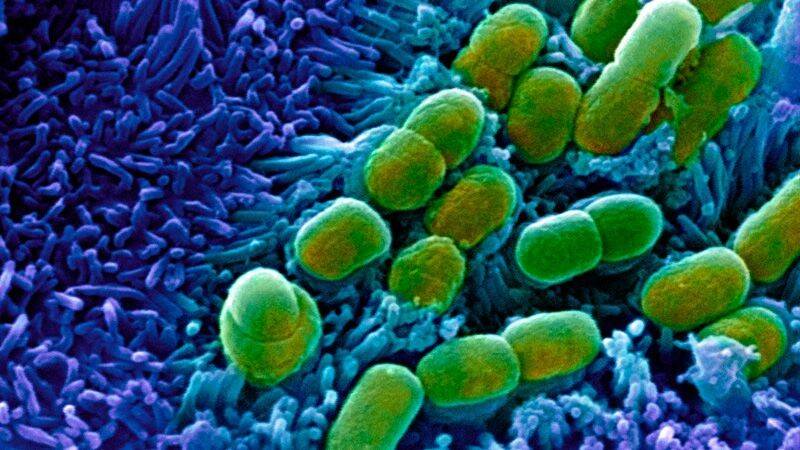 escherichia-coli-bacteria.jpg