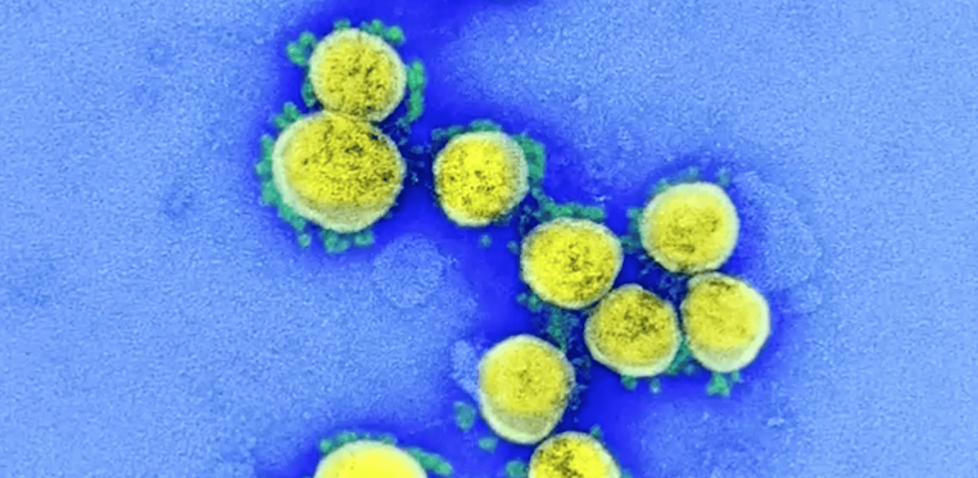 la-primeras-imagenes-coronavirus.png