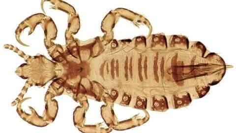 louse-4.jpg