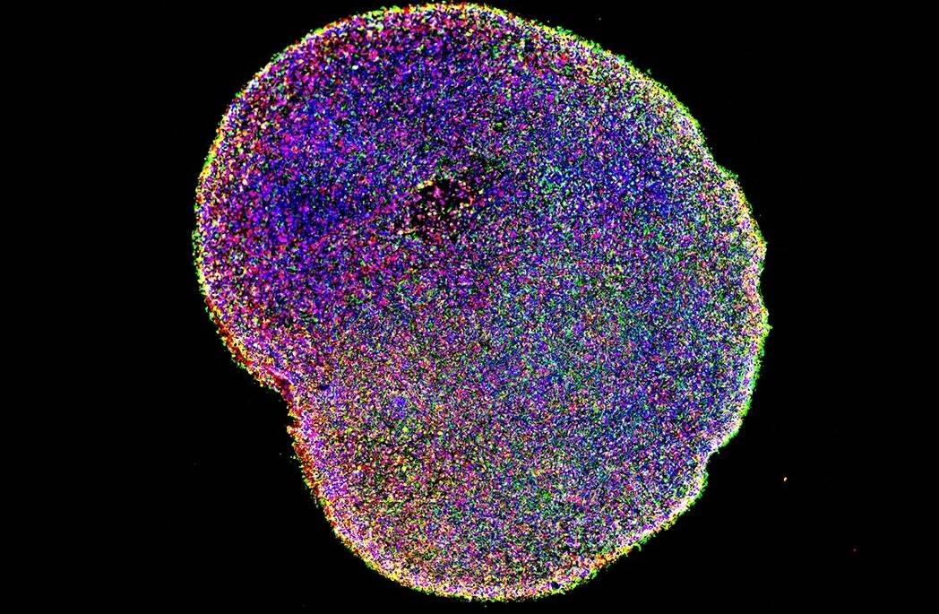 organoid-six-months.jpg