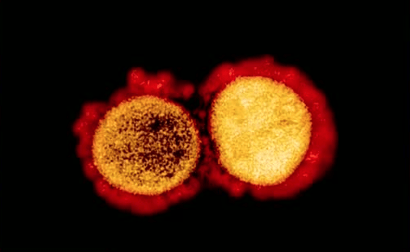 primeras-imagenes-coronavirus.png