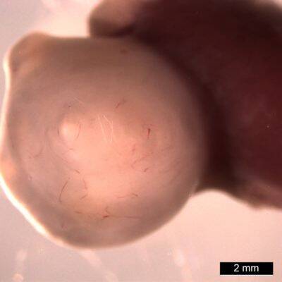 stomach-organoid-brightfield-e1638215024123.jpg