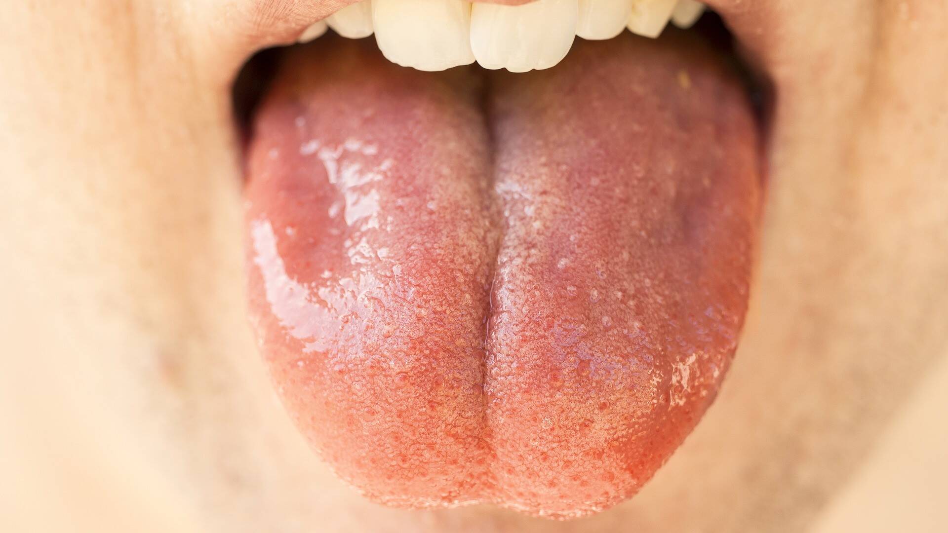 tongue-gd08f0d174_1920.jpg