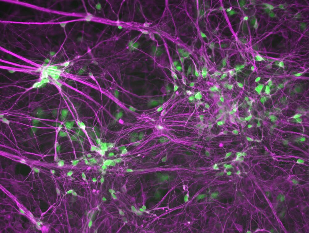 web-human-induced-motor-neurons-that-are-labeled-with-a-motor-neuron-marker-HB9-in-green-and-a-neuron-marker-TUJ1-in-purple-courtesy-of-Ichida-Lab.jpg