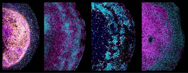 ZoomedHumanBrainFetalOrganoids.jpg