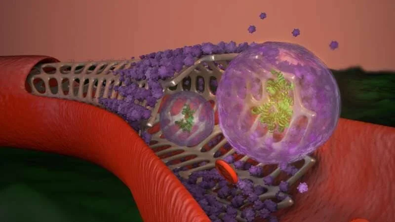 Representación 3D de un stent en un vaso sanguíneo liberando nanopartículas moradas hacia células tumorales.