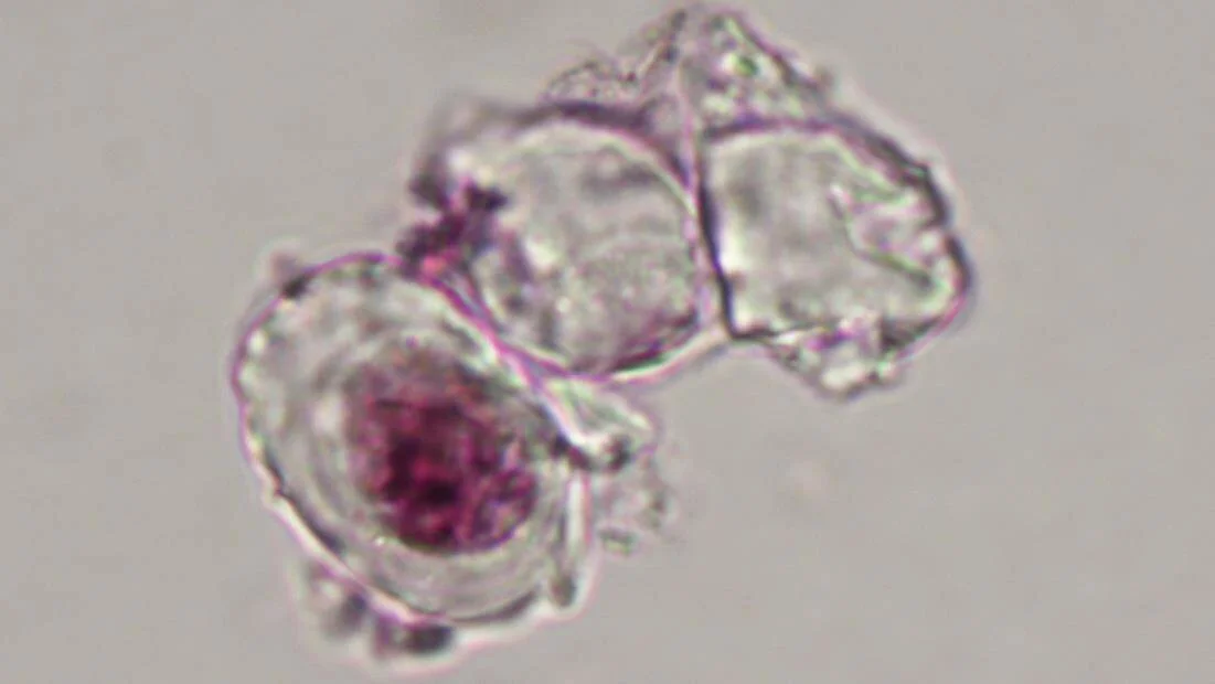 Imagen microscópica de tres células translúcidas con núcleo teñido de color magenta visible en una de ellas.