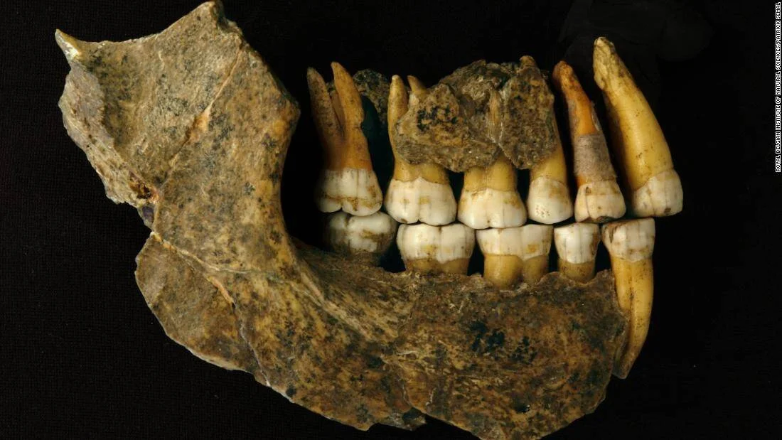 Fragmento de mandíbula fósil con dientes bien conservados, de coloración amarillenta y blanca, sobre fondo negro.