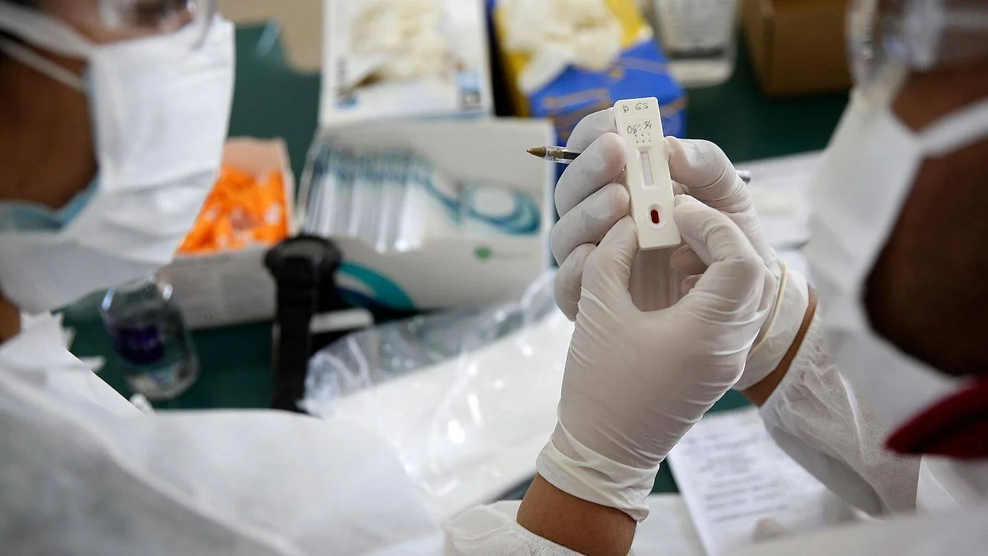 Manos enguantadas de un profesional sanitario sostienen un test de diagnóstico rápido etiquetado, en un entorno médico.