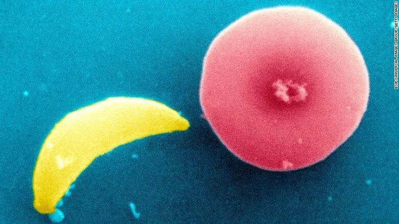 Imagen de microscopio electrónico coloreada que muestra un espermatozoide amarillo junto a un óvulo rosado sobre fondo turquesa.