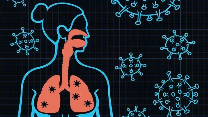 Diagrama ilustrado de una figura humana con pulmones infectados rodeada de partículas de virus, representando una enfermedad respiratoria.