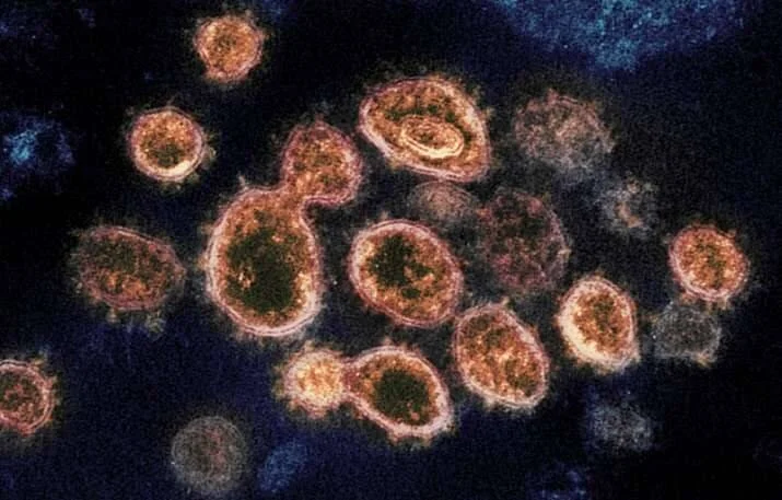 Imagen de microscopía electrónica coloreada que muestra múltiples partículas esféricas del coronavirus SARS-CoV-2 sobre fondo oscuro.