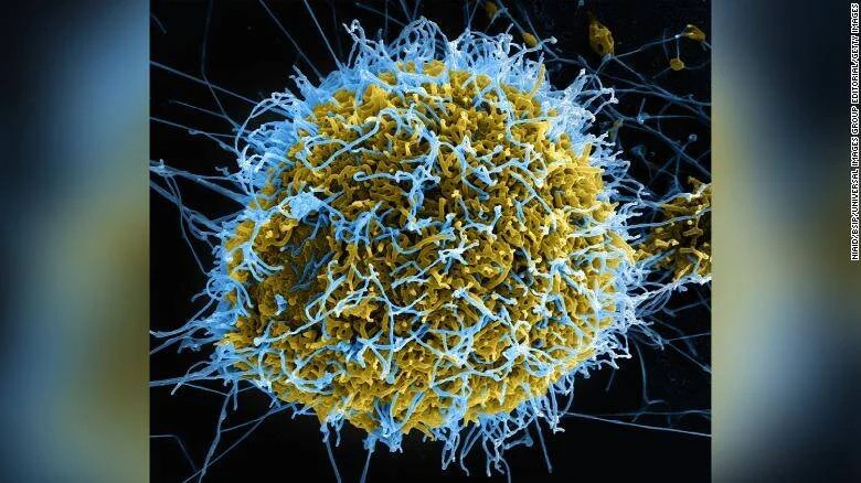 Imagen de microscopio electrónico de barrido coloreada muestra partículas del virus del Ébola emergiendo de una célula infectada.