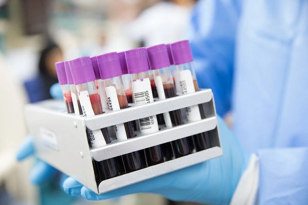 Personal de laboratorio con guantes azules sostiene una gradilla con tubos de muestras de sangre etiquetados con códigos de barras.