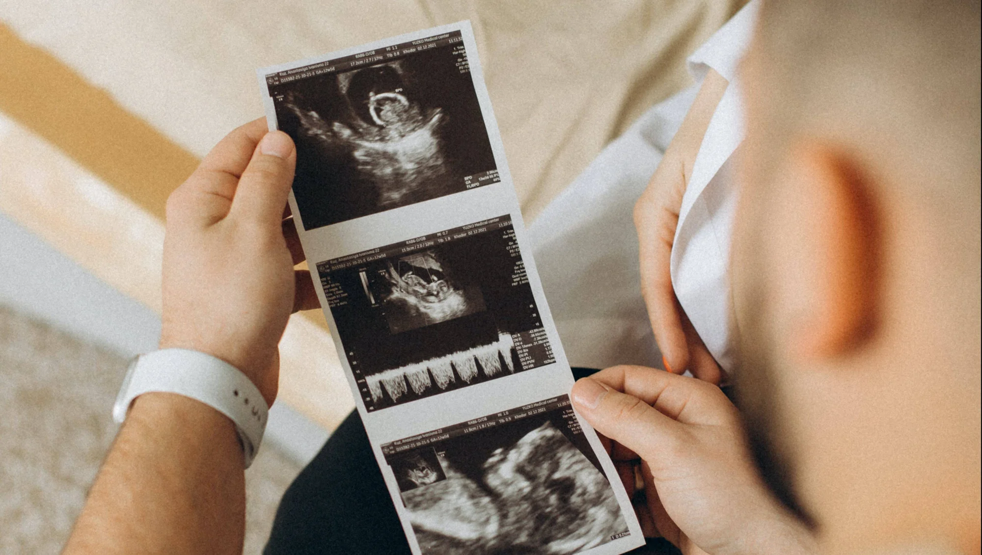 Una persona observa una tira con tres imágenes de ecografía fetal tomadas durante el embarazo.