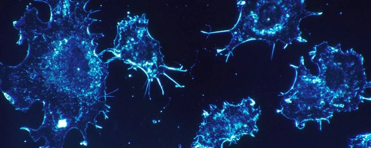 Células cancerosas iluminadas en azul fluorescente vistas al microscopio, mostrando prolongaciones irregulares sobre fondo oscuro.