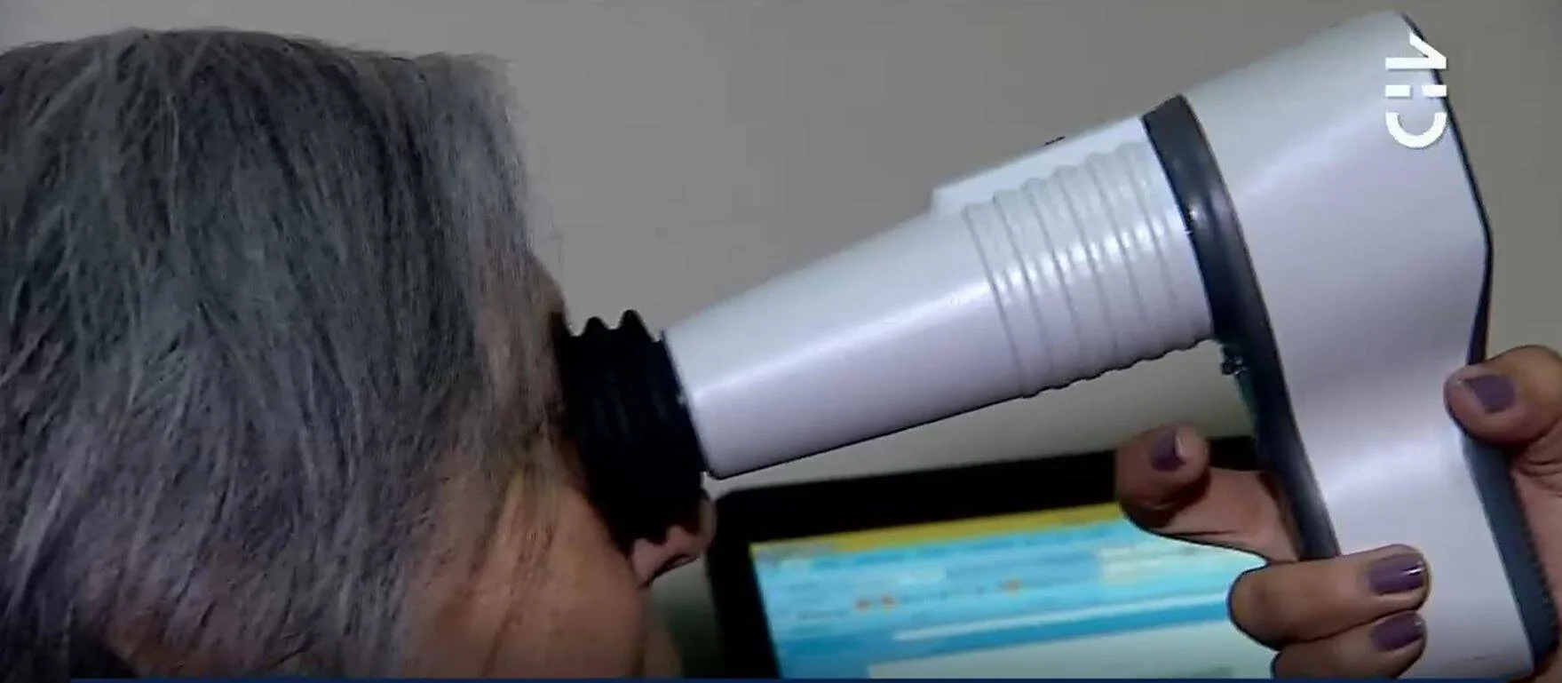 Profesional aplica un dispositivo oftalmológico portátil sobre el ojo de un paciente adulto mayor durante una revisión visual.