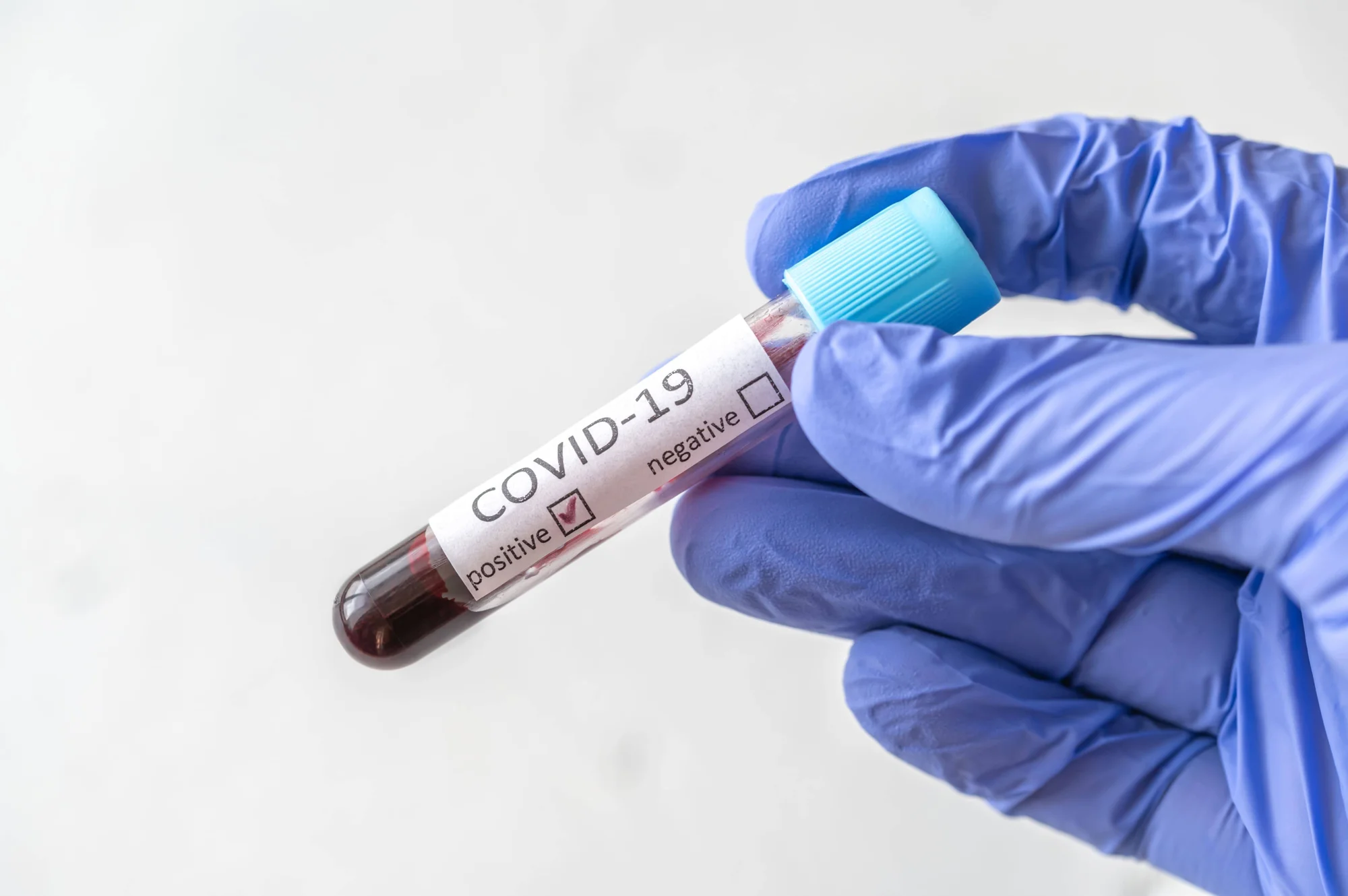 Mano con guante azul sosteniendo un tubo de muestra de sangre etiquetado como positivo para COVID-19.