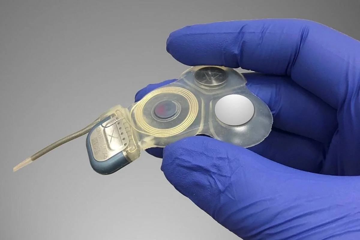 Mano con guante quirúrgico azul sostiene un pequeño dispositivo médico implantable con componentes electrónicos y una bobina de carga inalámbrica.