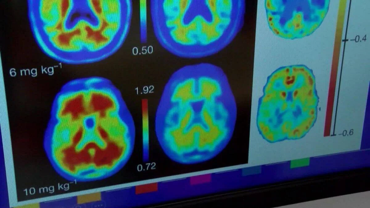 Pantalla con imágenes PET del cerebro en falso color comparando dosis de 6 mg/kg y 10 mg/kg de un fármaco.