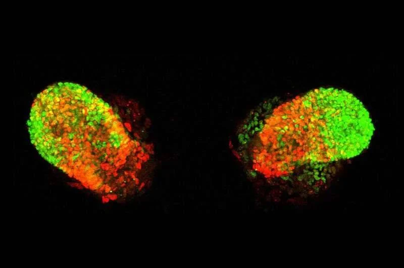 Dos organoides vistos al microscopio con fluorescencia, mostrando células marcadas en verde y rojo sobre fondo negro.