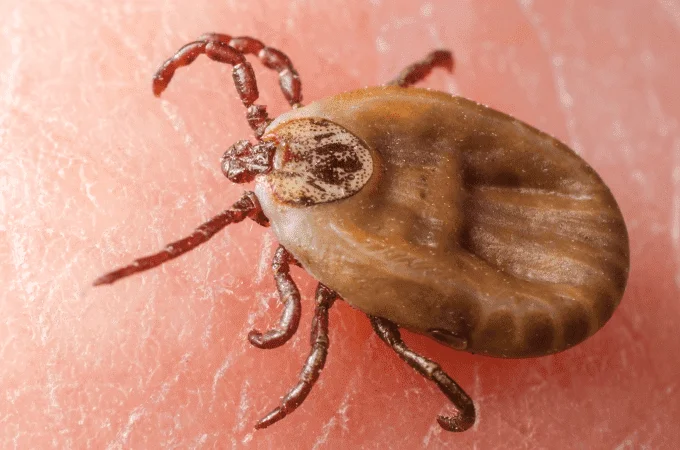 Garrapata marrón engordada vista en primer plano sobre piel humana, mostrando su cuerpo ovalado y patas articuladas.
