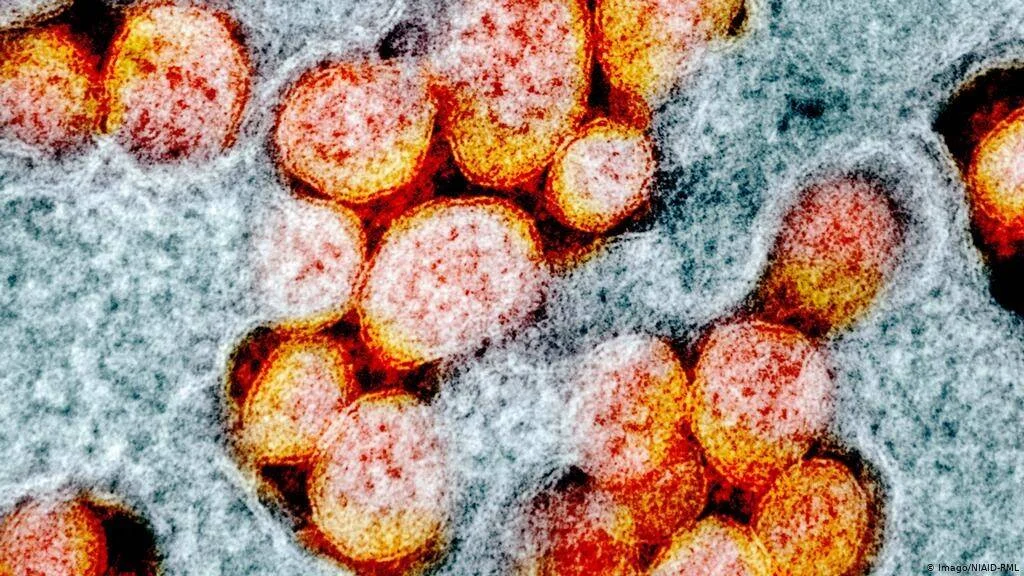 Micrografía electrónica coloreada que muestra partículas esféricas del coronavirus SARS-CoV-2 en tonos naranja y rojo.