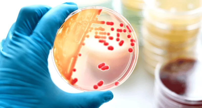 Mano con guante azul sostiene una placa de Petri con colonias de bacterias rojas cultivadas en medio de cultivo.