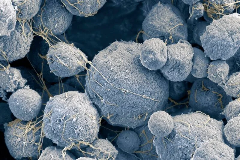 Imagen de microscopio electrónico coloreada que muestra partículas esféricas grises interconectadas por filamentos dorados.