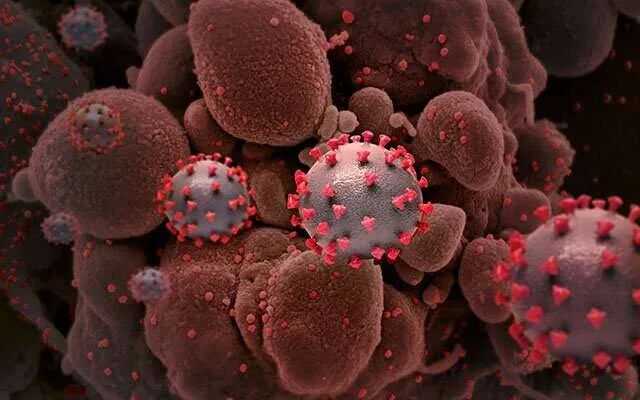 Ilustración microscópica de partículas del virus SARS-CoV-2 con proteínas spike rodeadas de células infectadas.