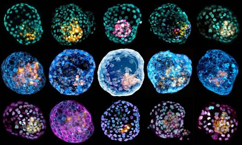 Colección de embriones humanos en etapa de blastocisto fotografiados con microscopía de fluorescencia en tonos verde, azul y magenta.
