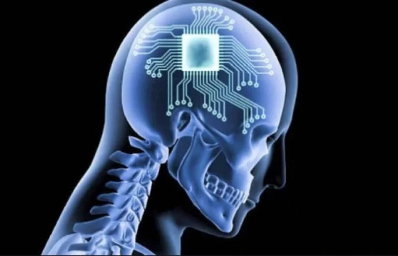 Ilustración de cráneo humano en rayos X con un microchip y circuitos electrónicos integrados en el cerebro.