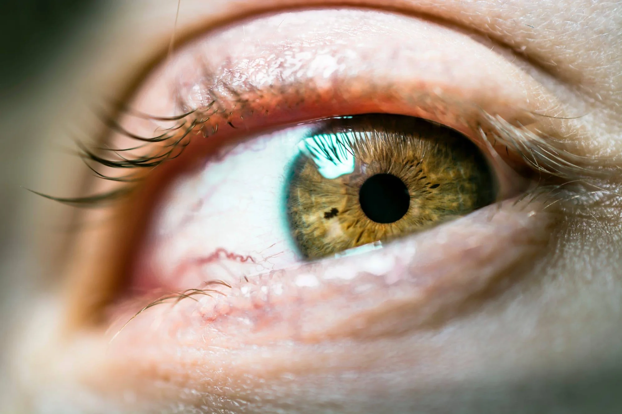 Macrofotografía de un ojo humano con iris de color verde-miel, pupila negra y conjuntiva enrojecida visible.