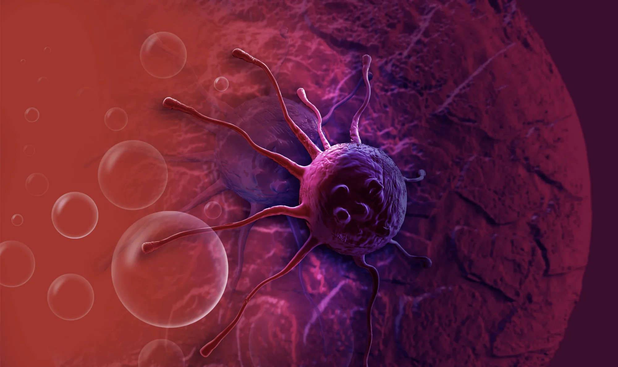 Representación digital tridimensional de una célula cancerosa con prolongaciones filiformes rodeada de glóbulos rojos.