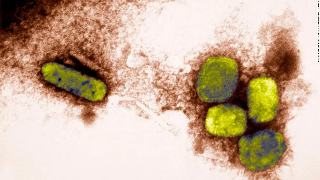 Micrografía electrónica coloreada muestra partículas del virus de la viruela del mono (mpox) en verde sobre fondo marrón.