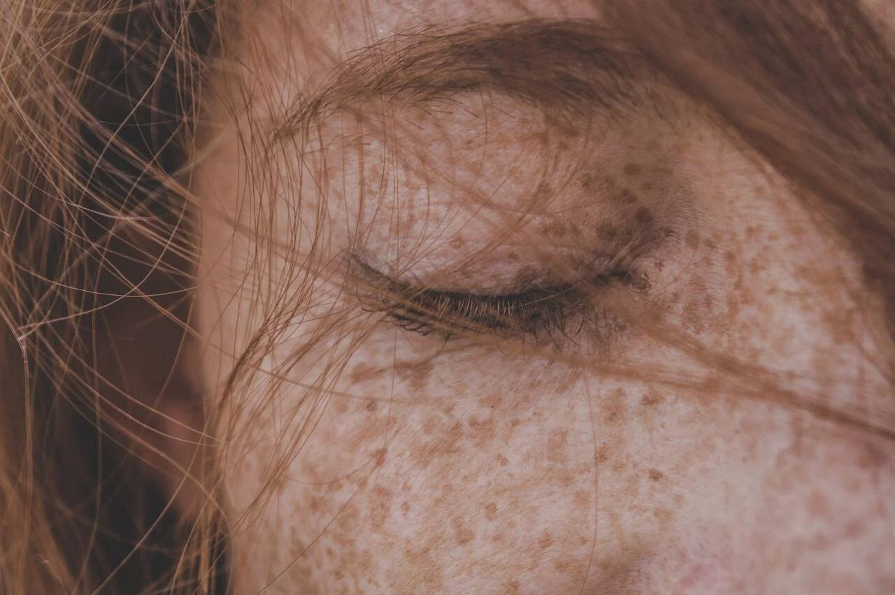 Primer plano del rostro de una persona con pecas, ojo cerrado y cabello rojizo sobre la cara.