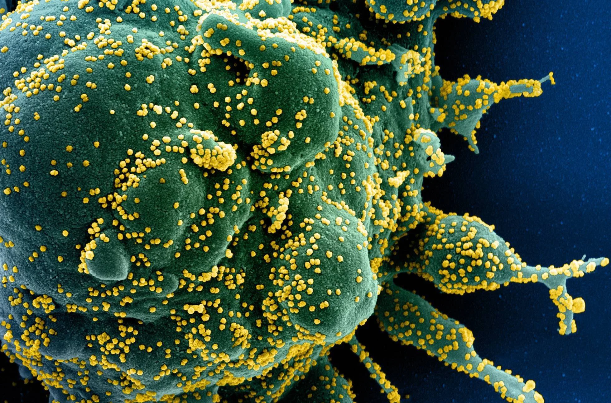 Micrografía electrónica coloreada de una célula (verde) densamente cubierta de partículas virales amarillas brotando de su superficie.