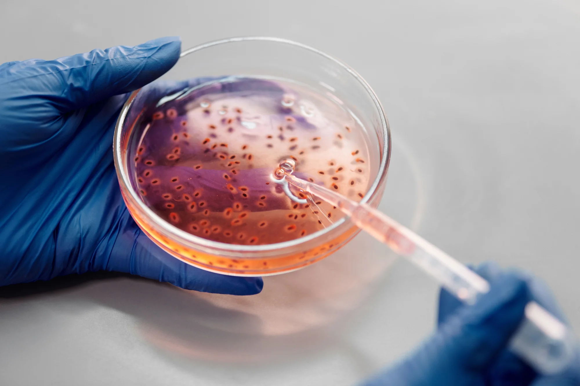 Manos con guantes azules sostienen una placa Petri con colonias bacterianas mientras se agrega una muestra con pipeta.