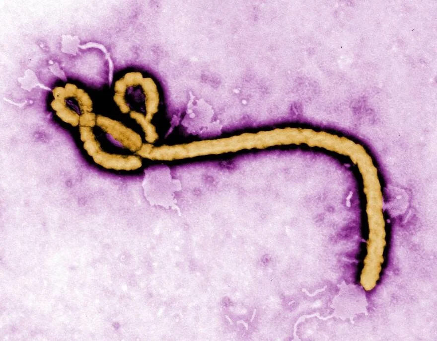 Micrografía electrónica coloreada que muestra una partícula filamentosa del virus Ébola en tonos amarillo y púrpura.