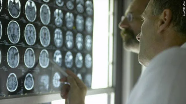 Un médico con bata blanca examina de cerca múltiples tomografías cerebrales colocadas en un negatoscopio.
