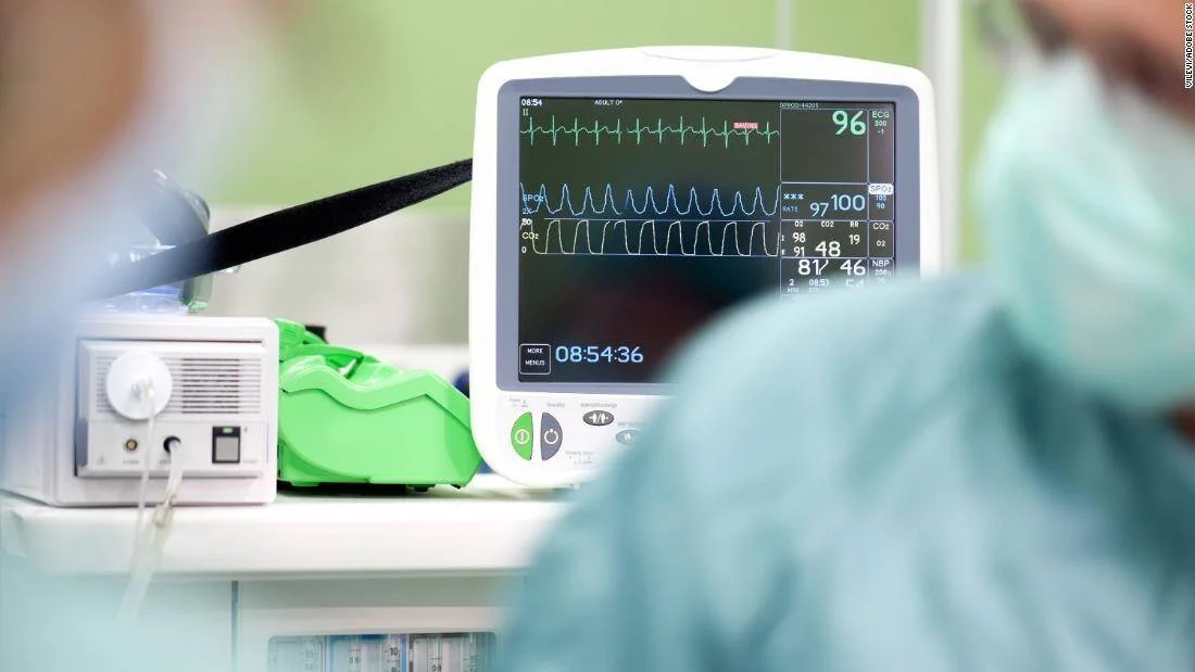 Monitor cardíaco mostrando ECG, frecuencia cardíaca y presión arterial mientras personal médico con mascarilla observa los datos del paciente.