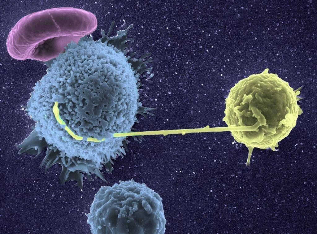 Microfotografía electrónica coloreada muestra células inmunitarias azules y amarilla conectadas por un nanotubo, con una célula rosa al fondo.
