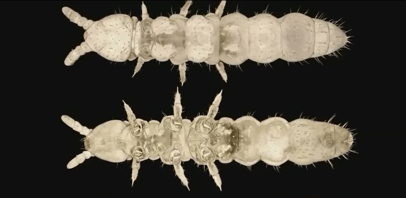 Dos especímenes de colémbolos fotografiados al microscopio: vista dorsal (arriba) y ventral (abajo) sobre fondo negro.