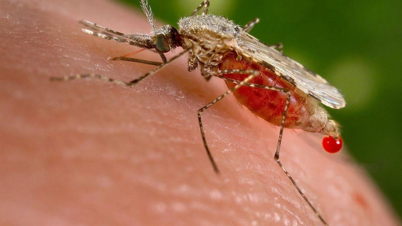 Mosquito con abdomen lleno de sangre picando la piel de una persona, con una gota de sangre visible en el punto de picadura.