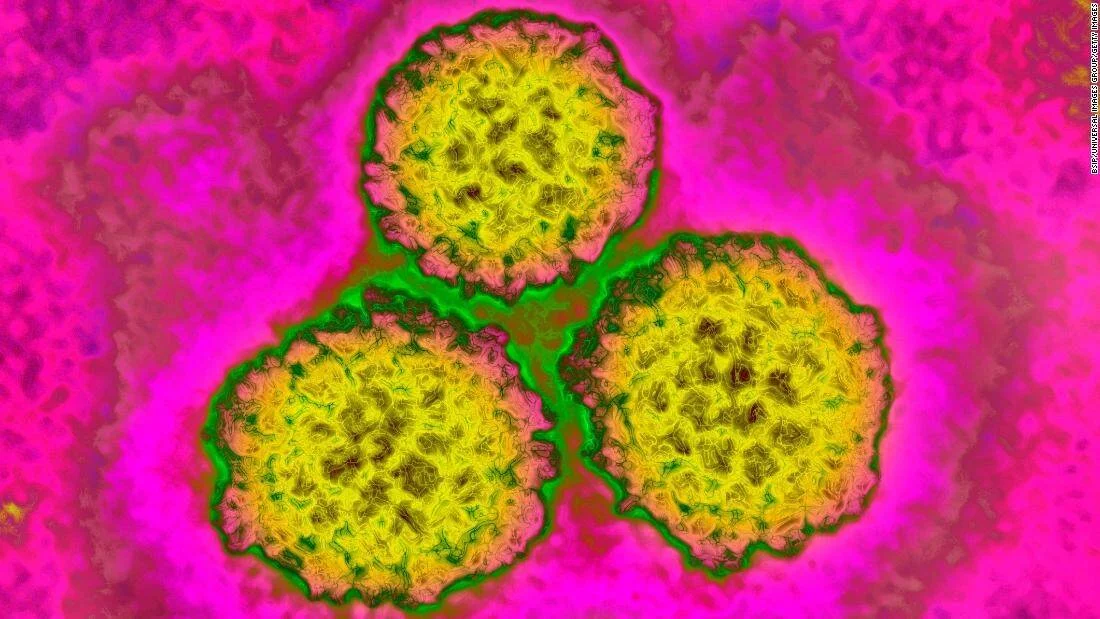 Micrografía electrónica con colores artificiales que muestra tres partículas virales esféricas en amarillo sobre fondo rosa.