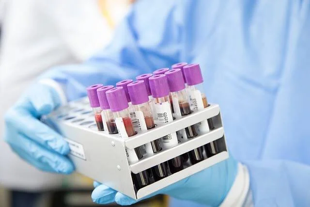Profesional de salud con guantes sostiene gradilla con tubos de muestras de sangre con tapones violetas.
